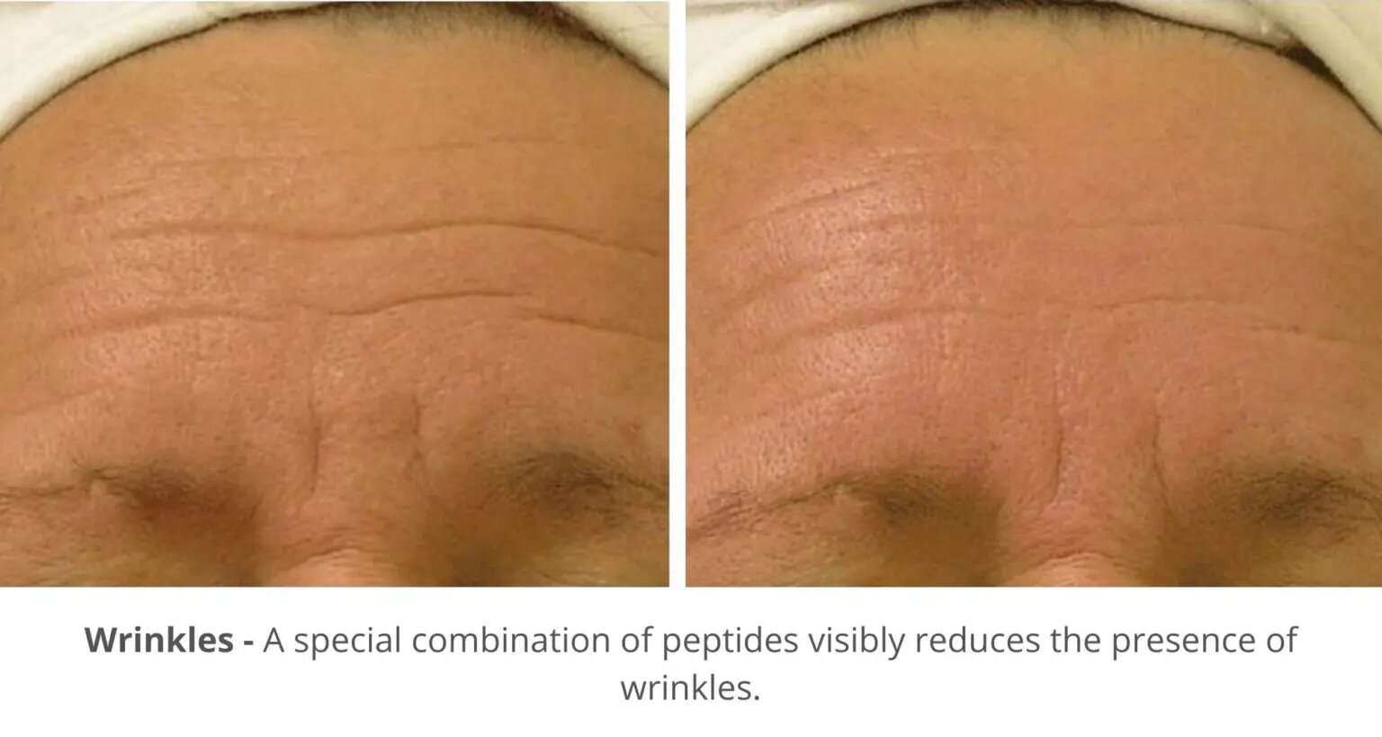 Wrinkles Solution Beautypro New York