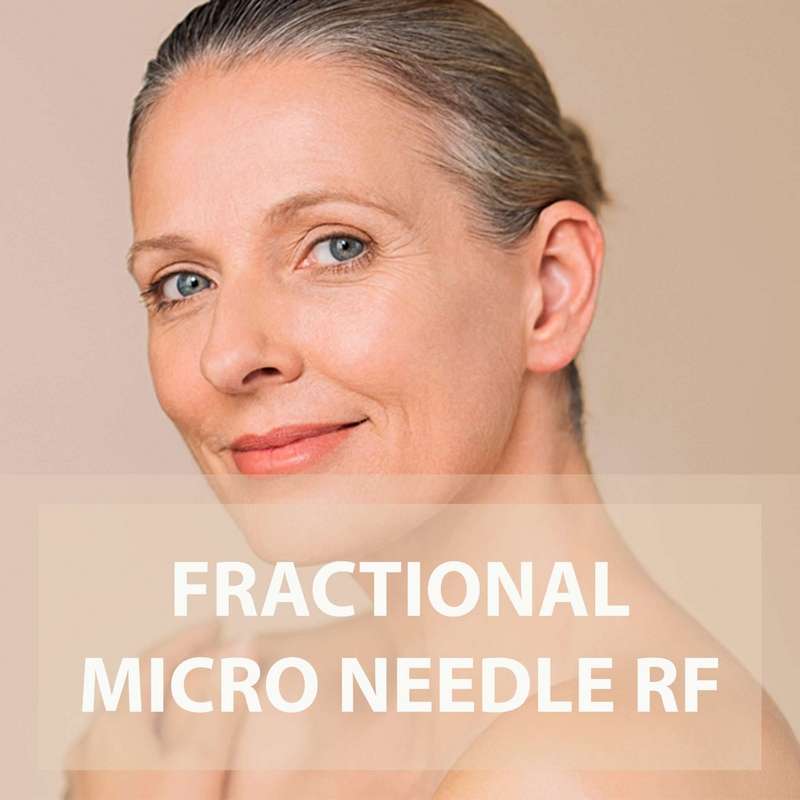 Fractional Micro Needle what is it