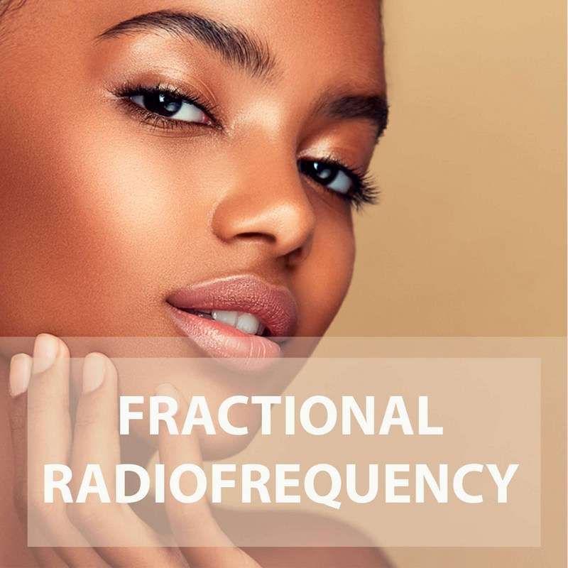 Fractional Radiofrequency what is it