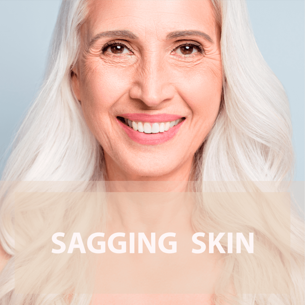 Sagging Skin Treatment service in New York