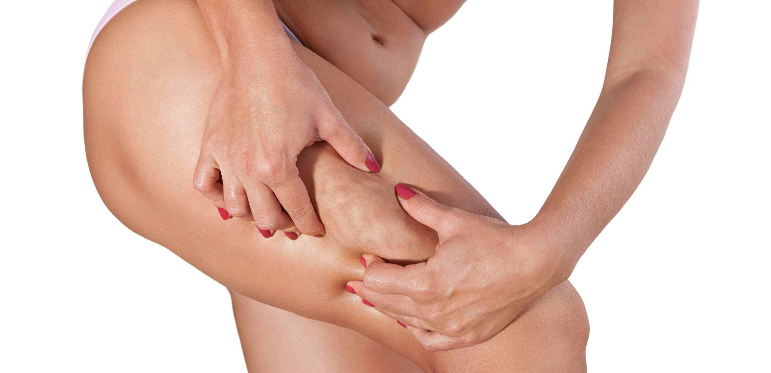 Treatments for Cellulite NYC